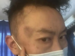 男子在派出所被拖进女厕群殴 警方：严肃处理相关人员